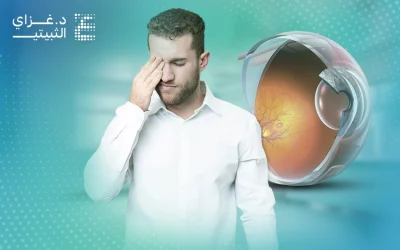 ارتشاح العين وتأثيره في الرؤية وكيفية الوقاية منه