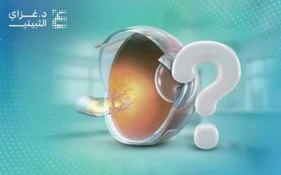 تعرف إلى أسباب الارتشاح على العصب البصري وسبل علاجه 