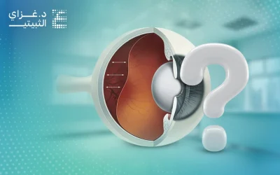 أسباب انفصال الشبكية 