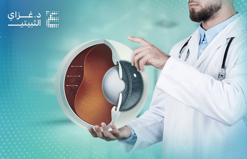 علاج انفصال الشبكية علاج انفصال الشبكية
