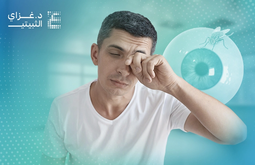 أسباب ظهور ذبابة العين