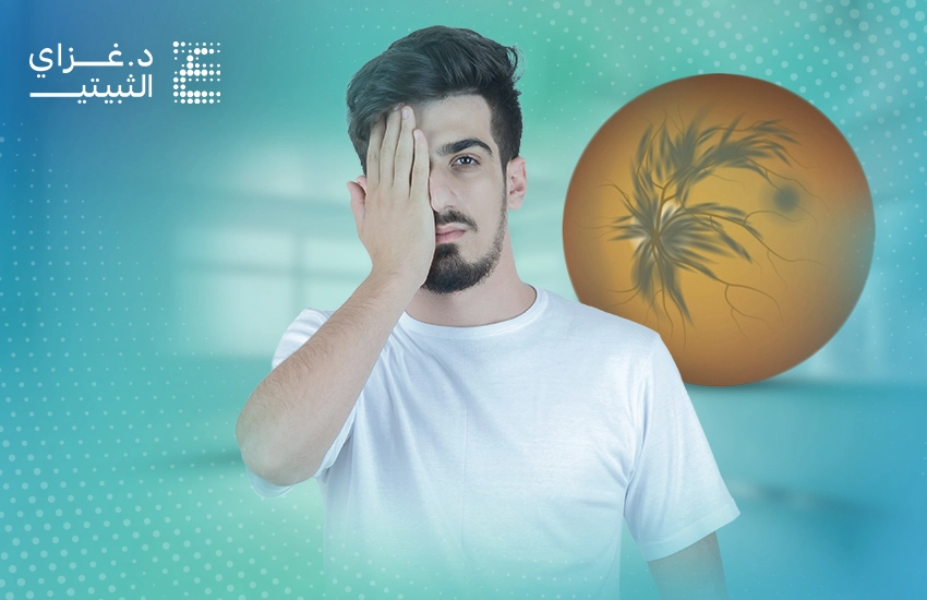 علاج انسداد الوريد الشبكي المركزي